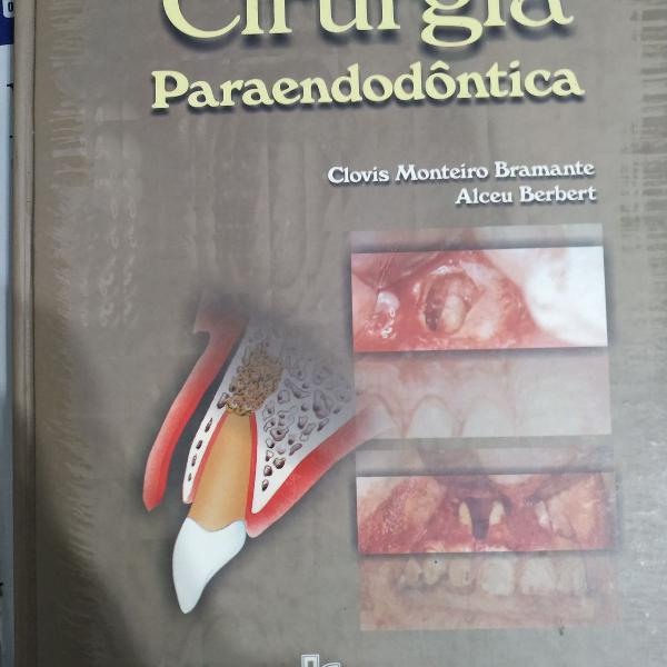 cirurgia parendodontica - clóvis monteiro bramante