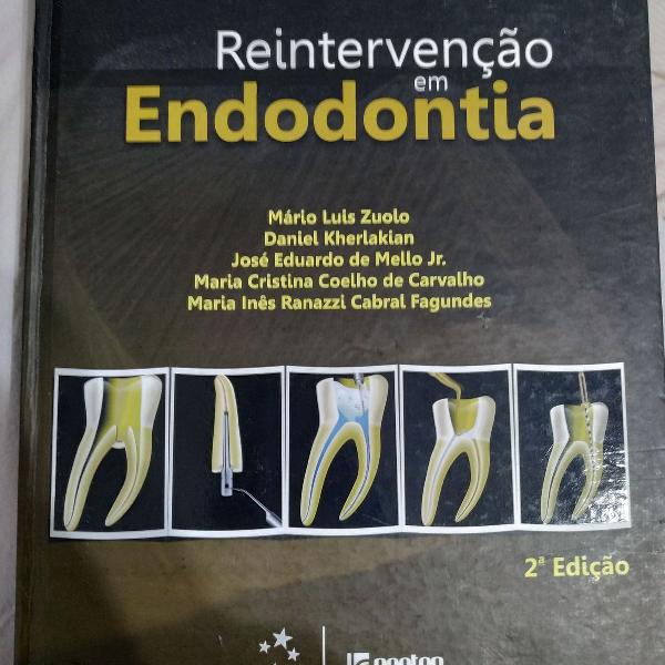 reintervençao em endodontia - mário luiz zuolo - 2a