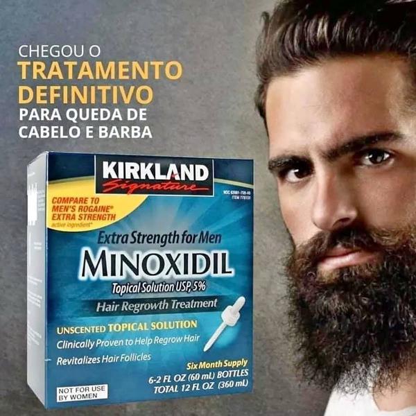 minoxidil importado kirkland 5%