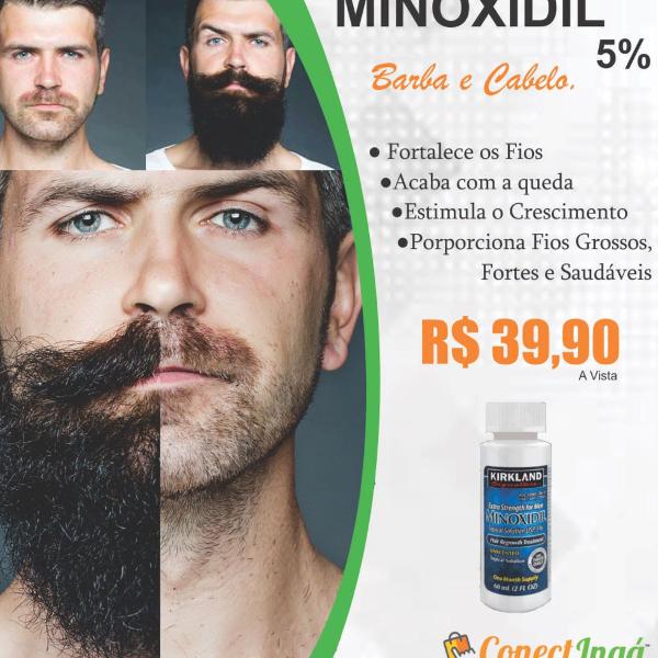 minoxidil kirkland 5%