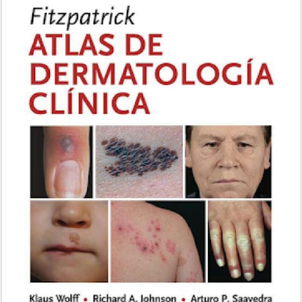 Dermatologia de Fitzpatrick: Atlas e Texto