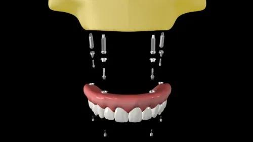 Marketing Para Dentistas - 25 Animações Para Mídias