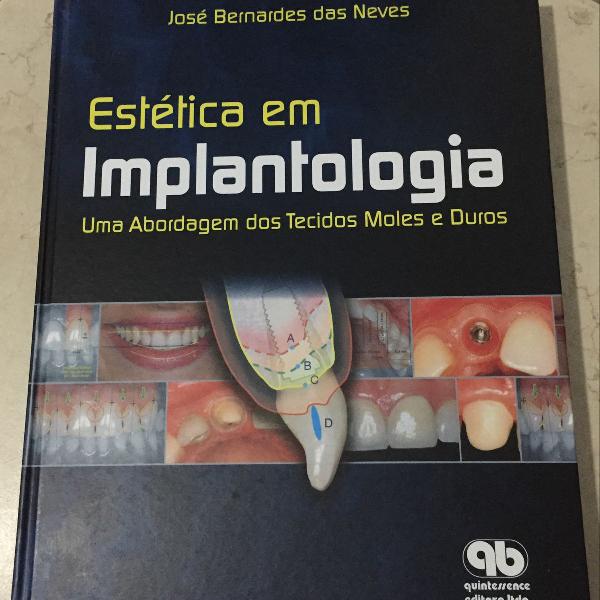 livro: estética em implantologia