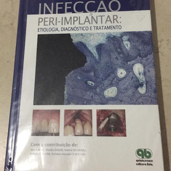 livro: infecção peri-implantar: etiologia, diagnóstico e