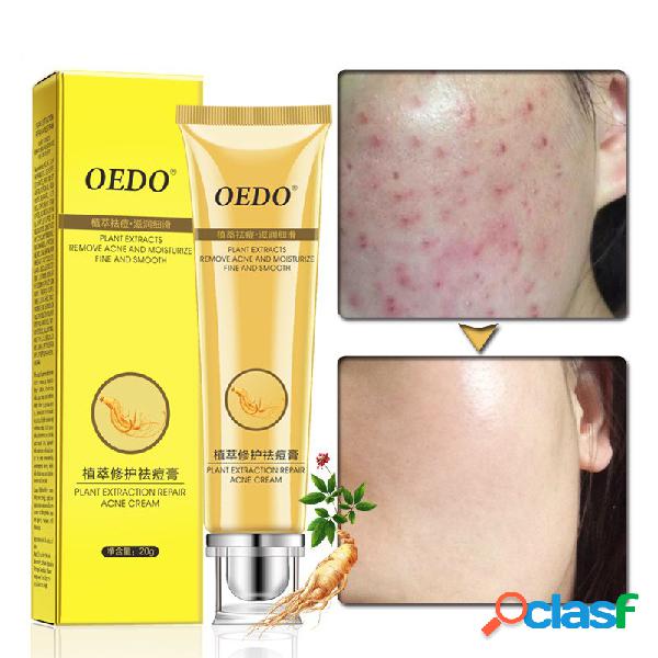 20g Reparação Acne Creme Extração Da Planta de