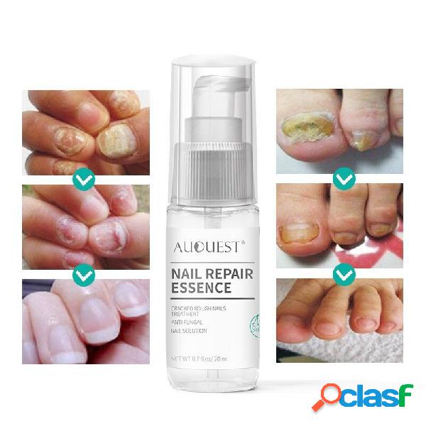 20 ml Prego Essência de Reparação de Unhas Antifúngicas