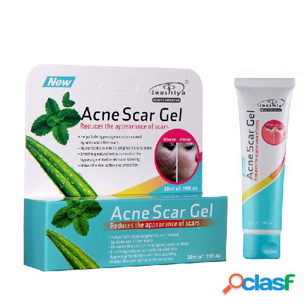 Cicatriz Acne Gel Cuidados Com A Pele Remover Reparação