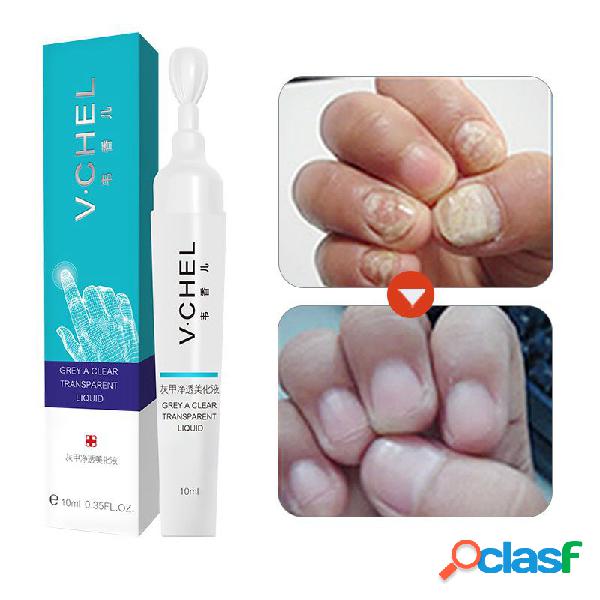 Tratamento de Unhas Fúngicas Caneta Essência Pé