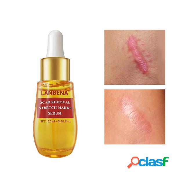 20 ml cicatriz remoção soro clareamento hidratante