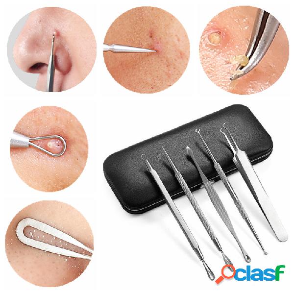 5Pcs Removador de acne Extractor Aço inoxidável Ferramenta