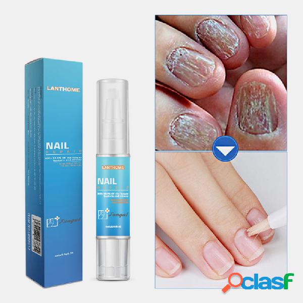 Unhas Caneta de Reparação Reparação Poderosa Paroníquia