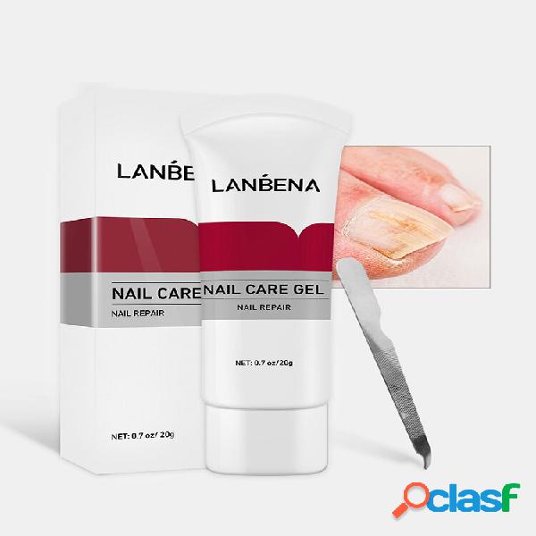 Creme para remoção de fungos nas unhas Remoção de