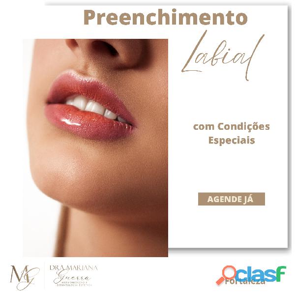 Preenchimento Harmonização Facial Consultório em